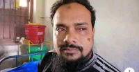 বামনায় হত্যা মামলার আসামির হামলায় দৈনিক আমাদের সময়ের সাংবাদিক টিপু রক্তাক্ত