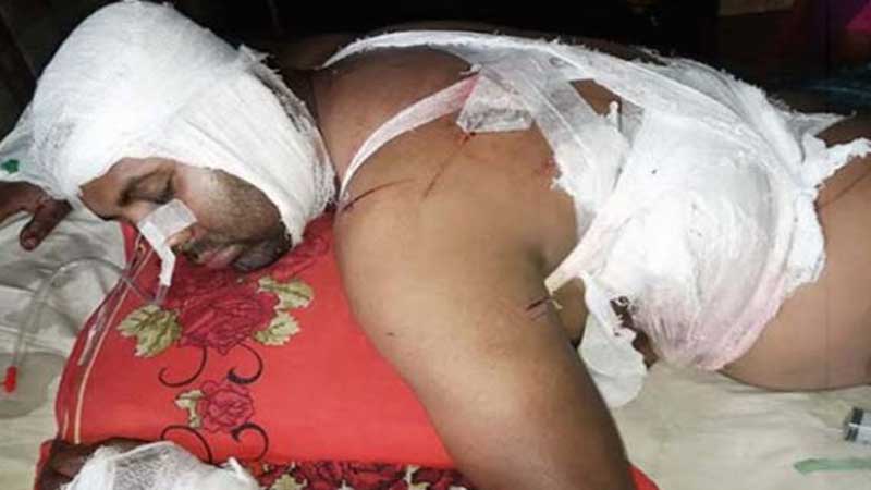 মাদক বিক্রেতে বাঁধা দেওয়ায় কুপিয়ে জখম