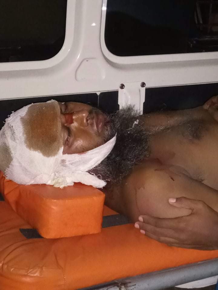 পাথরঘাটায় মৎস্য ব্যবসায়ীকে কুপিয়ে জখম লক্ষাধিক টাকা ছিনতাই